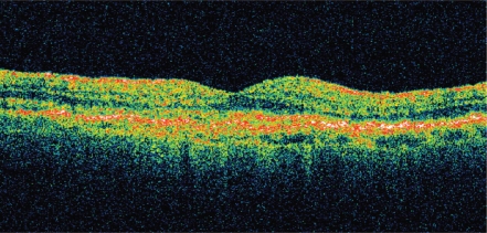 Figure11b