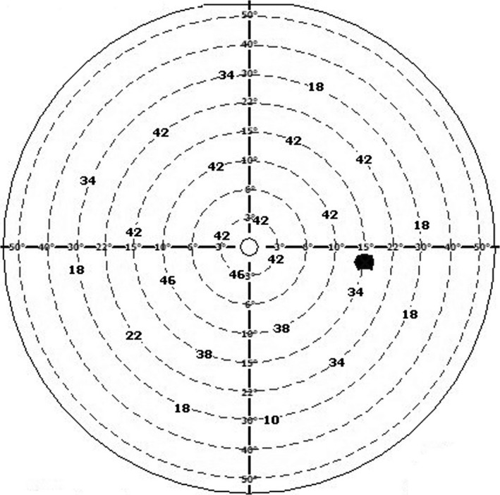 FIGURE 2