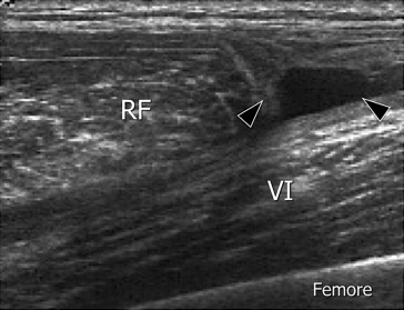 Fig. 11