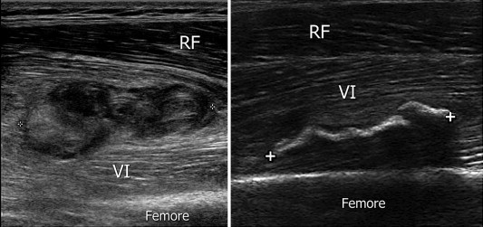 Fig. 13