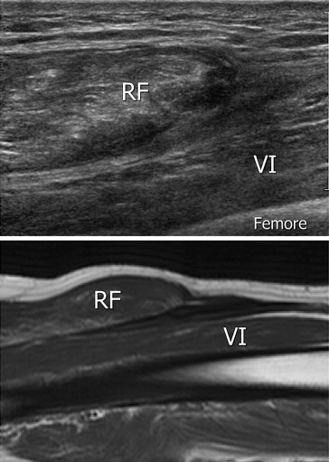 Fig. 12