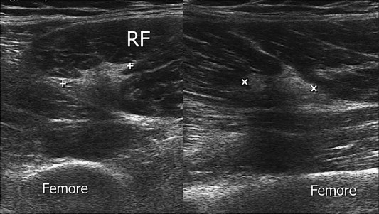 Fig. 10