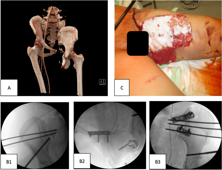 Fig. 2