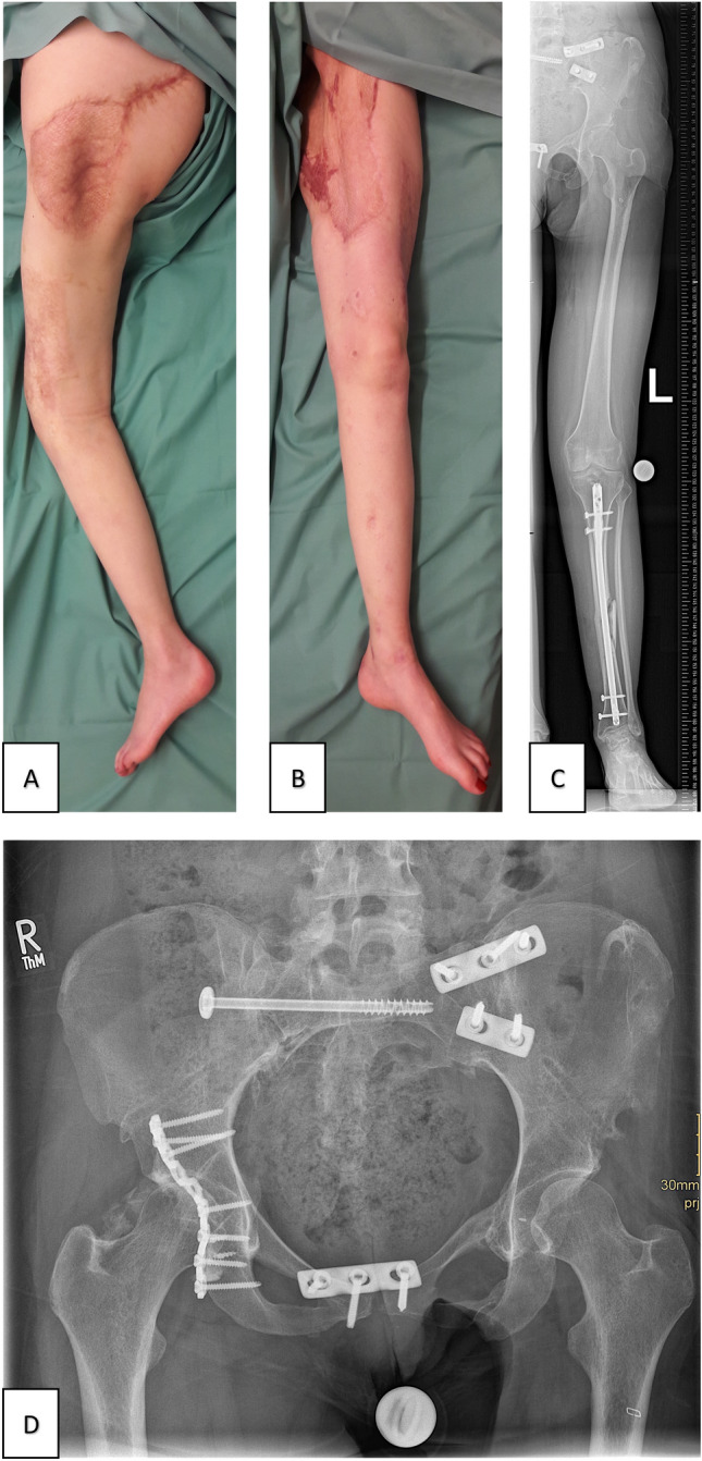 Fig. 7