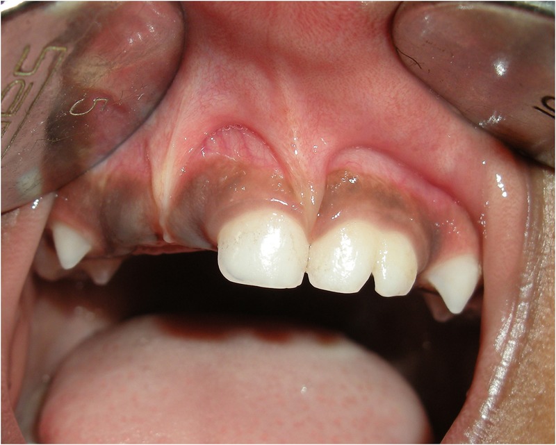 Figure 1