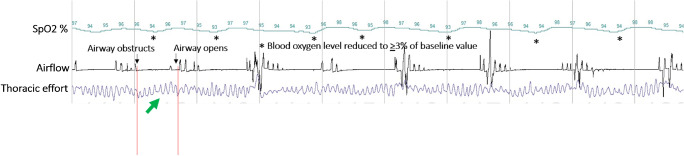 Fig. 7