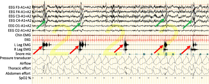 Fig. 4
