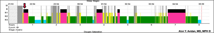 Fig. 3