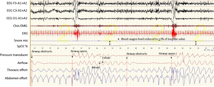 Fig. 2
