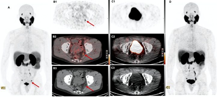 Fig 3