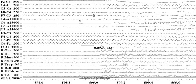 Fig. 1