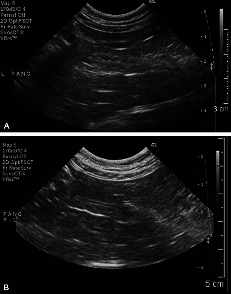 Fig 2.