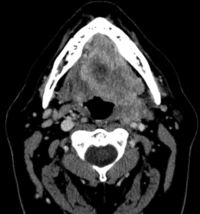 Fig 1.