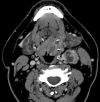 Fig 2.