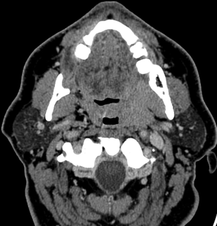 Fig 3.