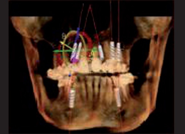 Figure 14