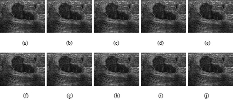 Figure 17