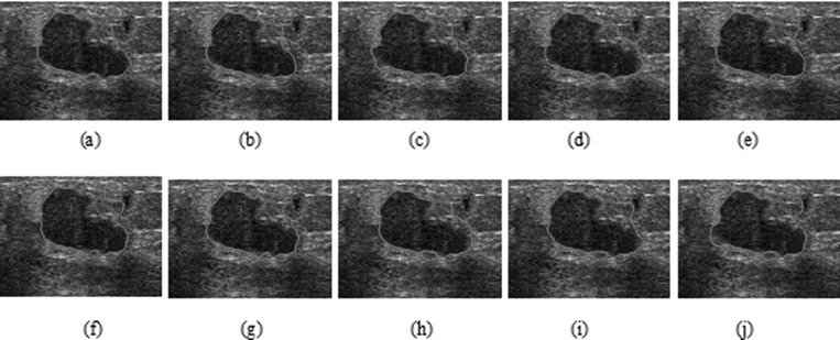 Figure 16