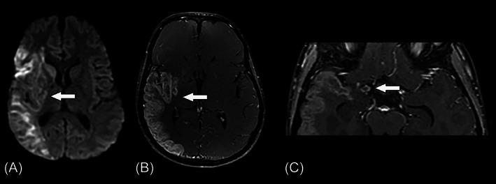 FIGURE 3