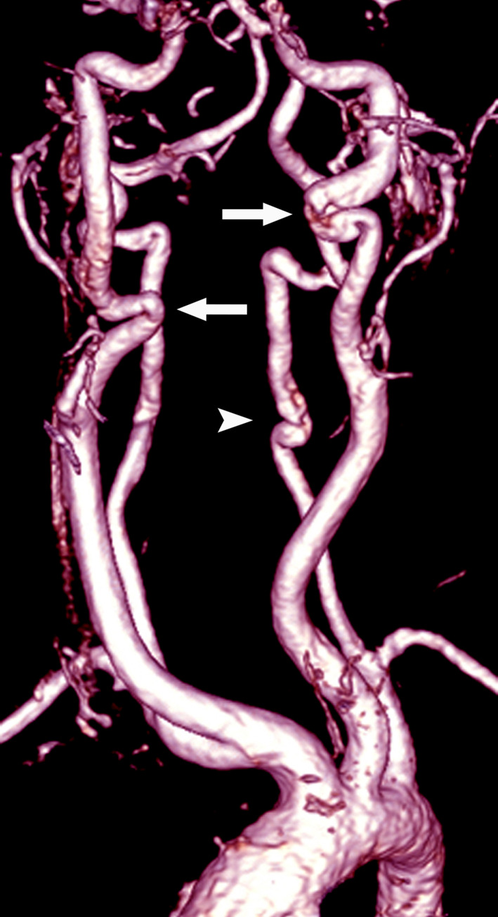 FIGURE 2