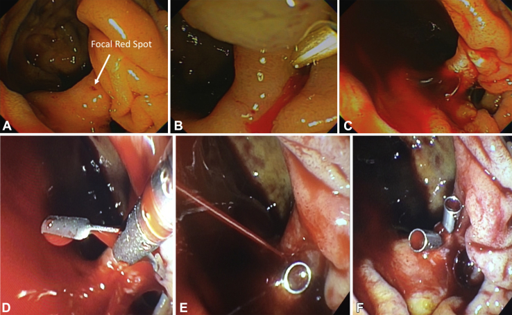 Figure 1