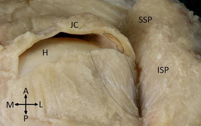 Fig. 1