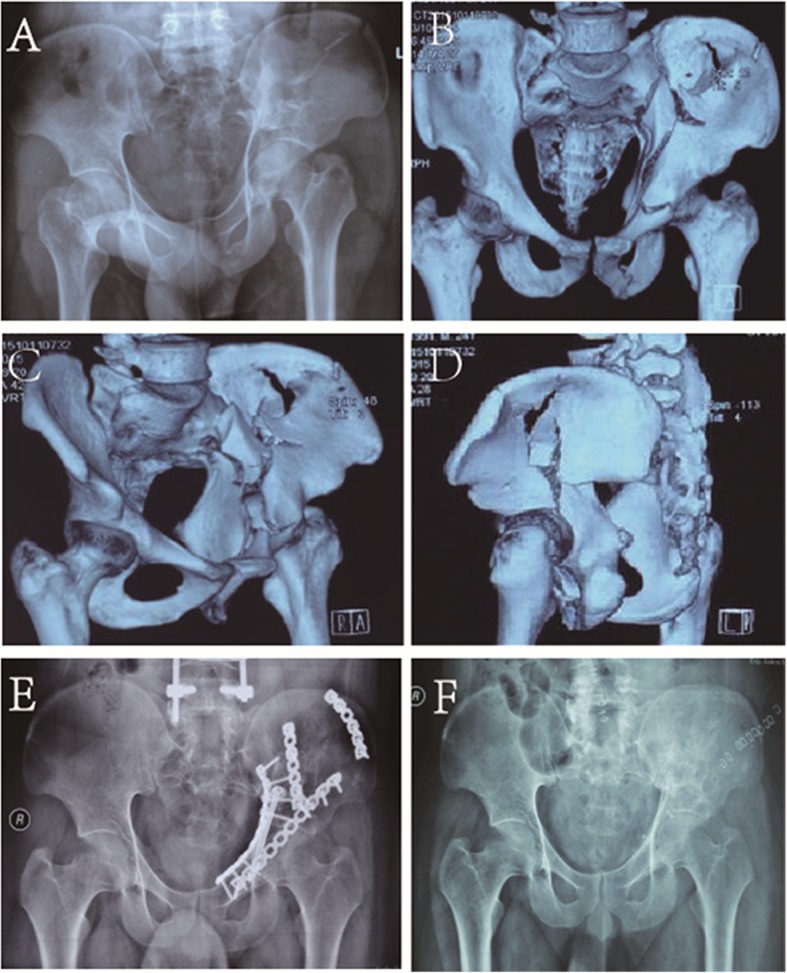 Fig. 4