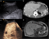 Fig. 10