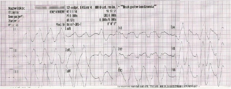 Fig. 2