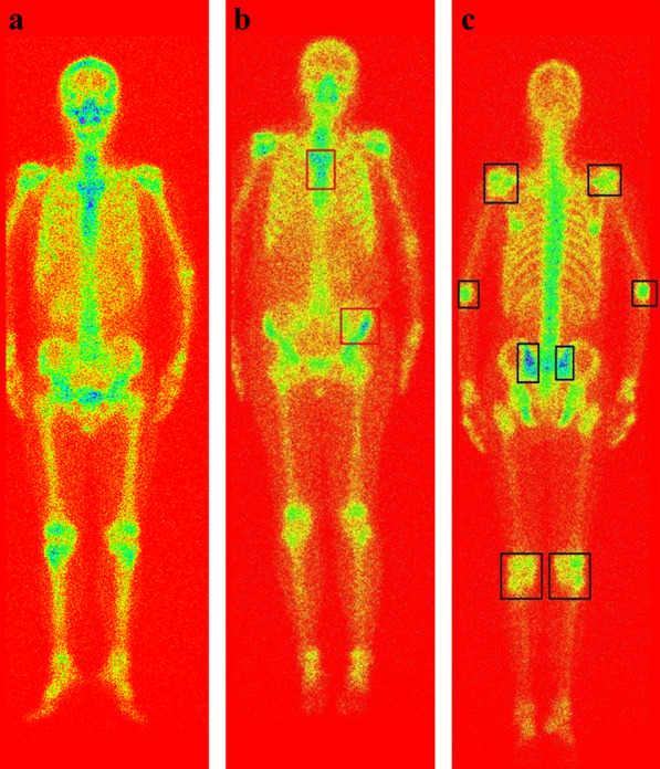 Fig. 12