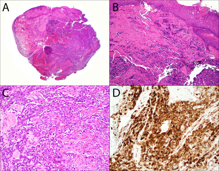 Fig. 2