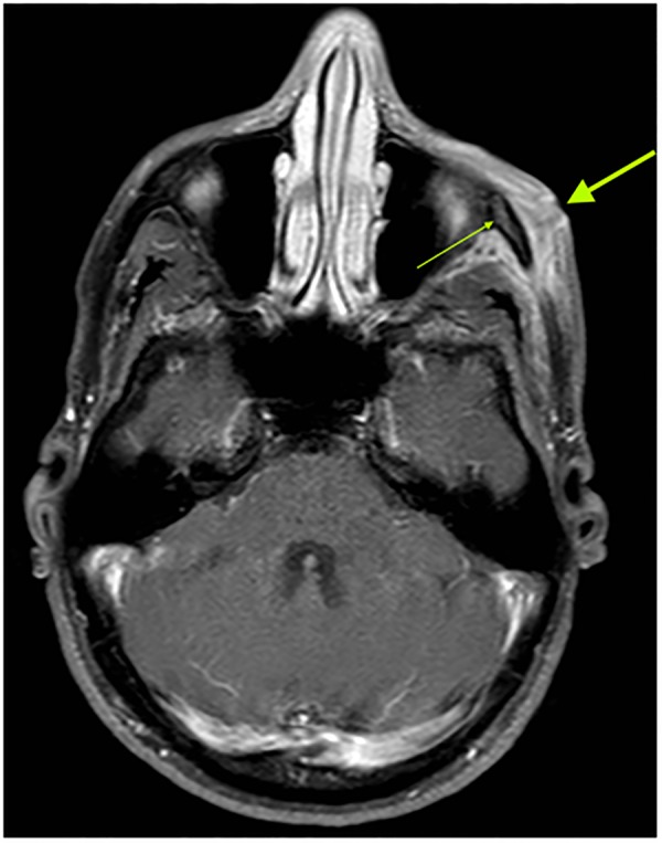 Figure 3