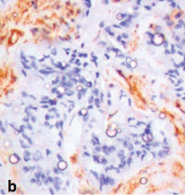 [Table/Fig-5b]: