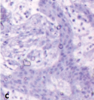 [Table/Fig-4c]: