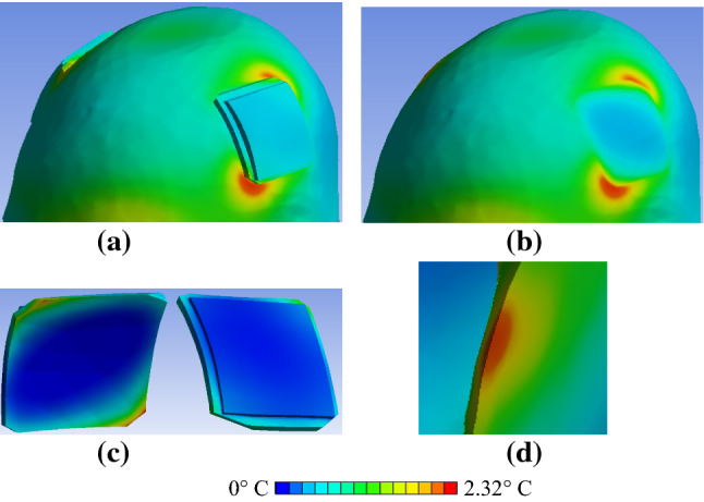 Fig. 9