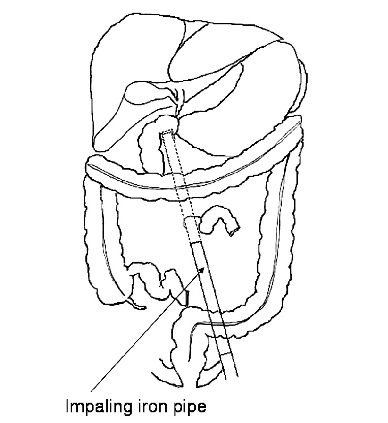 Fig. 4