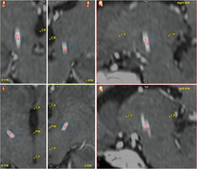 Figure 2.