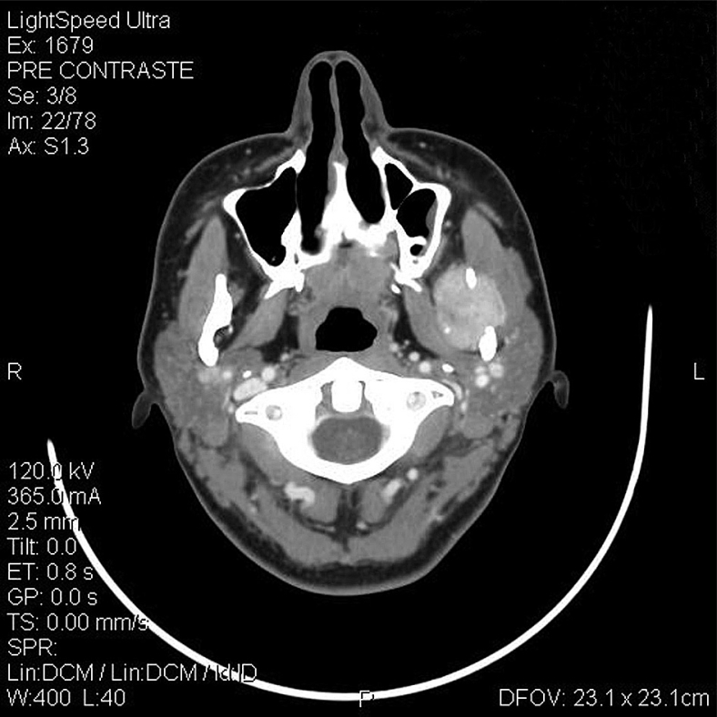 Figure 2