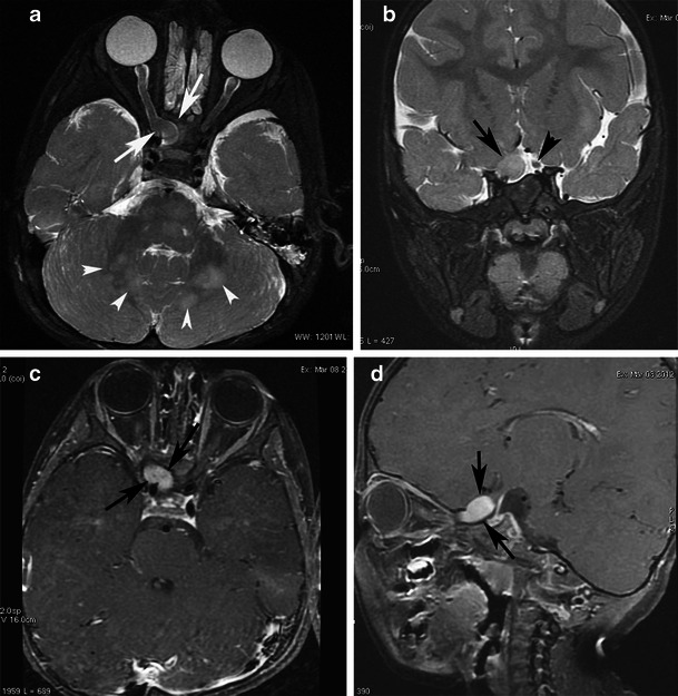 Fig. 14