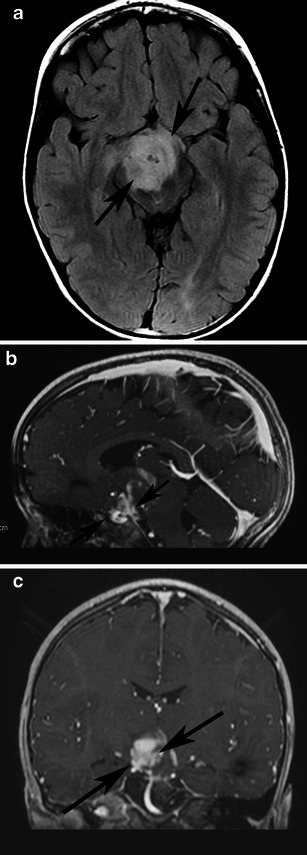 Fig. 13