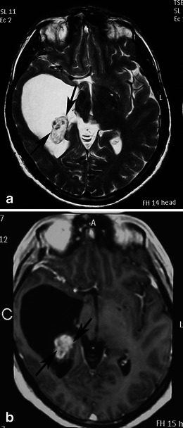 Fig. 15