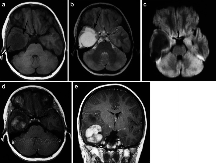 Fig. 17