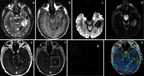 Fig. 16