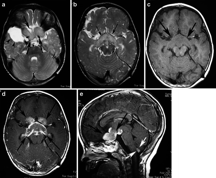 Fig. 12