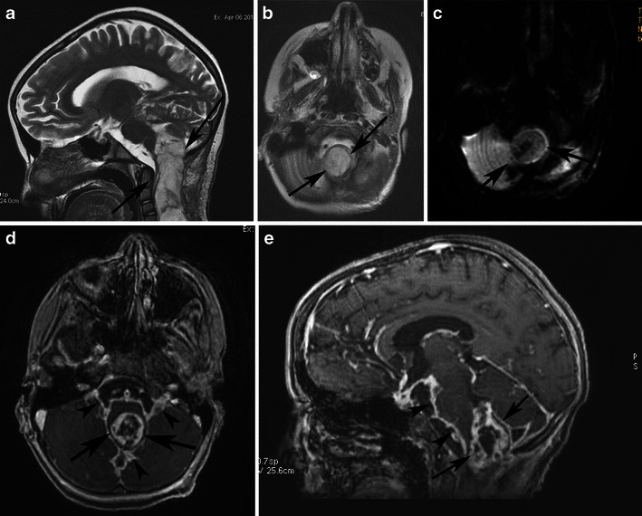 Fig. 11