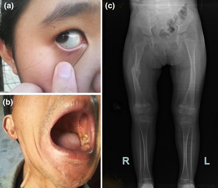 Figure 2