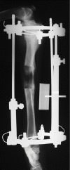 Fig.2