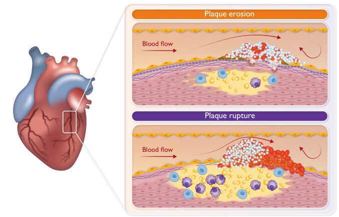 Graphical Abstract