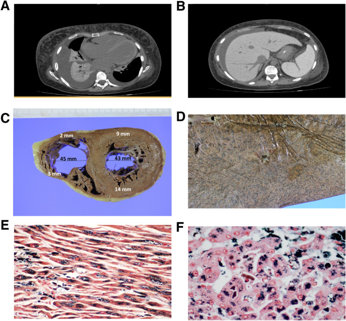 Fig. 1