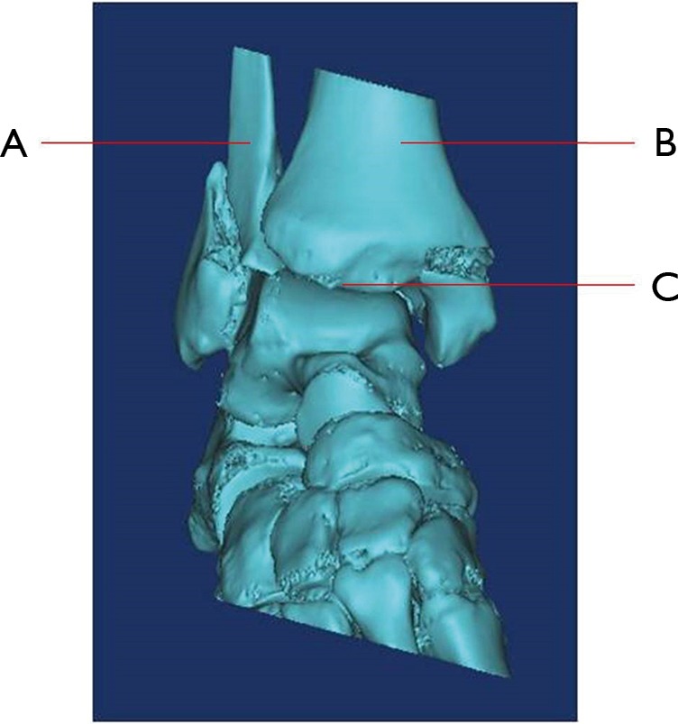 graphic file with name atm-06-20-403-fig2.jpg